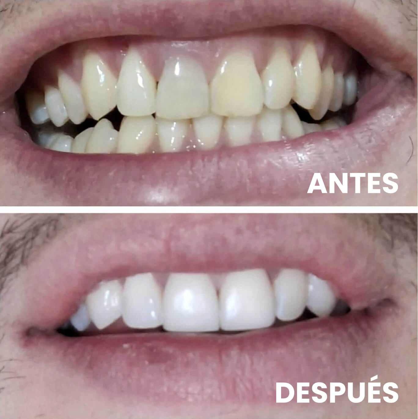 Dentista en Guadalajara Imagen paciente