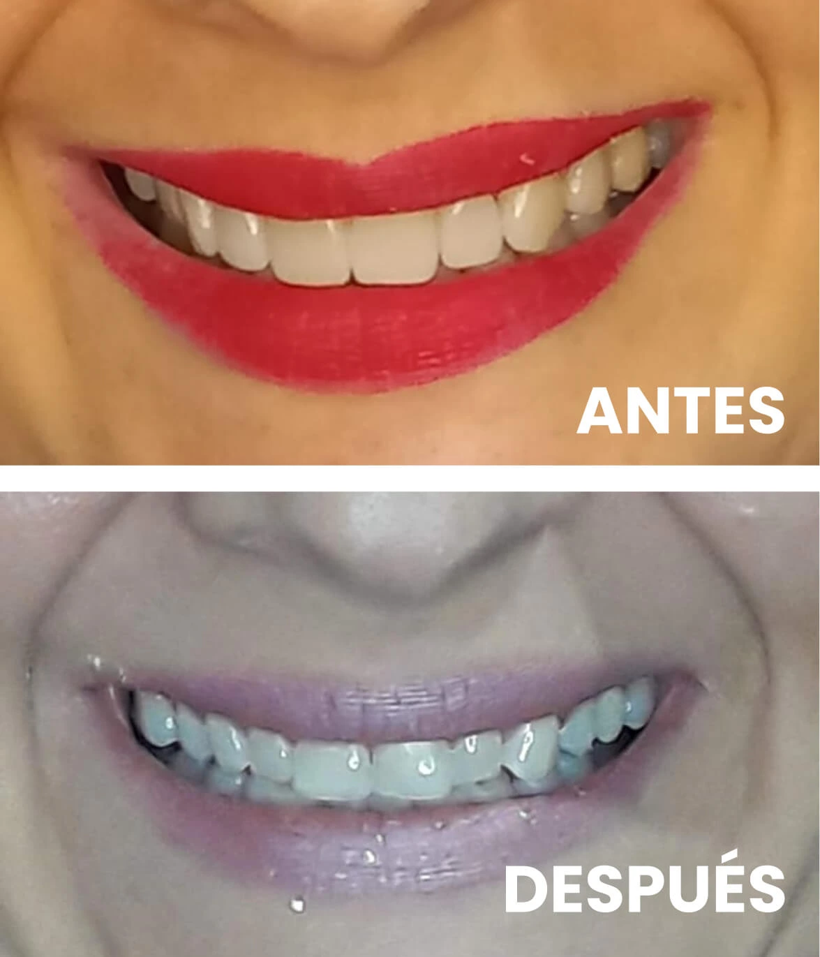 Dentista en Guadalajara Imagen paciente
